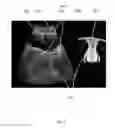 Fig. 06 - Ultrasound simulation methods