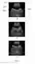Fig. 09 - Ultrasound simulation methods