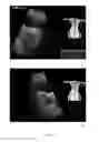 Fig. 10 - Ultrasound simulation methods