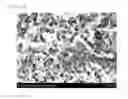 Fig. 07 - Anode having double-protection layer formed thereon for lithium secondary battery, and lithium secondary battery comprising same