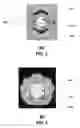 Fig. 03 - Method and apparatus for use with a radio distributed antenna having a fiber optic link