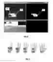 Fig. 09 - APPARATUS, SYSTEMS, AND METHODS FOR TRACKING MEDICAL PRODUCTS USING AN IMAGING UNIT