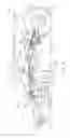 Fig. 04 - Automatic fore/aft leveling trim function in a towable tillage implement