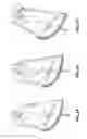 Fig. 04 - APPARATUS FOR CATCHING INSECTS