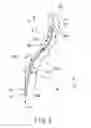 Fig. 04 - Flexible tube insertion apparatus