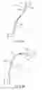 Fig. 07 - Flexible tube insertion apparatus
