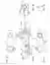 Fig. 16 - Shortened Slit Lamp Microscope