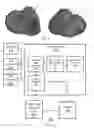 Fig. 02 - System and Method for Imaging Episodic Cardiac Conditions