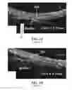 Fig. 04 - Handheld device for identification of microbiological constituents in the middle ear