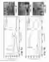 Fig. 08 - Handheld device for identification of microbiological constituents in the middle ear
