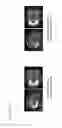 Fig. 09 - SENSITIVITY EVALUATION METHOD