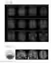 Fig. 20 - SENSITIVITY EVALUATION METHOD