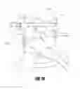 Fig. 22 - Hip surgery systems and methods