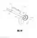 Fig. 29 - Hip surgery systems and methods