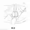 Fig. 32 - Hip surgery systems and methods