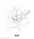 Fig. 35 - Hip surgery systems and methods