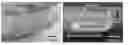 Fig. 01 - Appendage mountable electronic devices conformable to surfaces