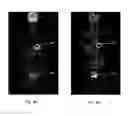 Fig. 09 - System and method for whole body continuous bed motion PET scanning with bi-directional data acquisition modes
