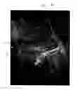 Fig. 01 - Ultrasound imaging apparatus and controlling method for the same