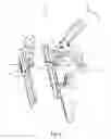 Fig. 02 - Spine surgery retractor system and related methods