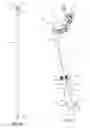 Fig. 15 - Spine surgery retractor system and related methods