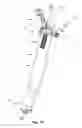 Fig. 24 - Spine surgery retractor system and related methods