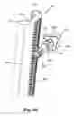 Fig. 29 - Spine surgery retractor system and related methods