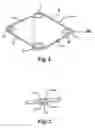 Fig. 02 - Expansion ring for eyeball tissue
