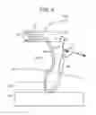 Fig. 06 - Multi-piece anchor inserter