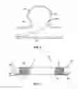 Fig. 02 - Embolic Occlusion Device And Method