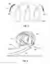 Fig. 07 - Embolic Occlusion Device And Method
