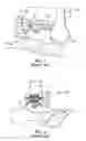 Fig. 02 - Surgical instrumentation and methods of use for implanting a prosthesis