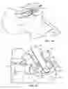 Fig. 22 - Surgical instrumentation and methods of use for implanting a prosthesis