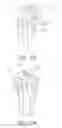 Fig. 49 - METHODS AND APPARATUS FOR PERFORMING KNEE ARTHROPLASTY