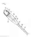 Fig. 01 - Stone retrieval balloon catheter