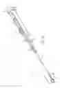 Fig. 02 - Stone retrieval balloon catheter
