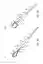 Fig. 04 - Stone retrieval balloon catheter