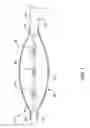 Fig. 02 - Lithotripsy angioplasty devices and methods