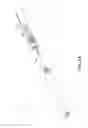 Fig. 08 - Catheter-based system for delivery and retrieval of a leadless pacemaker