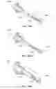 Fig. 35 - Catheter-based system for delivery and retrieval of a leadless pacemaker