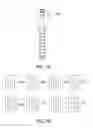 Fig. 08 - DISC AND MOTION PRESERVING IMPLANT SYSTEM