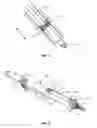 Fig. 05 - Spinal implant system and method
