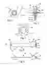 Fig. 02 - BONE PLATES, SCREWS AND INSTRUMENTS