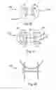 Fig. 08 - BONE PLATES, SCREWS AND INSTRUMENTS