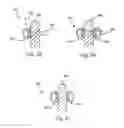 Fig. 09 - BONE PLATES, SCREWS AND INSTRUMENTS
