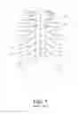 Fig. 02 - Sternum fixation device and method