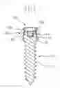 Fig. 09 - Surgical screw and fusion device using same