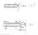 Fig. 07 - Side-fire laser system with stand-off catheter, standoff catheter, and method of using surgical laser to achieve both tissue vaporization and rapid coagulation to prevent or halt bleeding