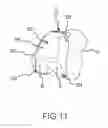 Fig. 23 - Arthroplasty jigs with mating accuracy