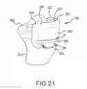Fig. 35 - Arthroplasty jigs with mating accuracy